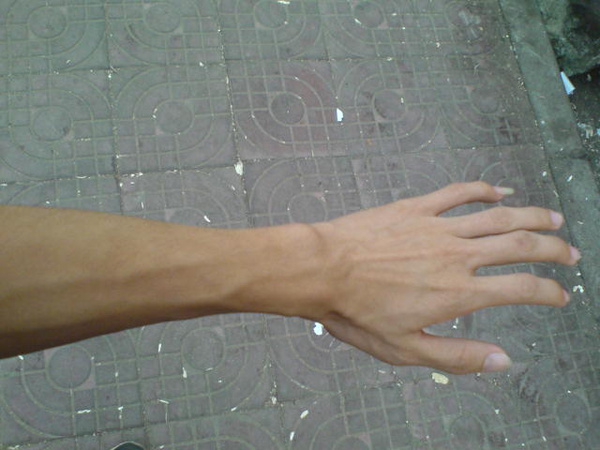 ‘泛亚电竞官网’盘点:三种阴道炎如何用药(图2) 泛亚电竞平台