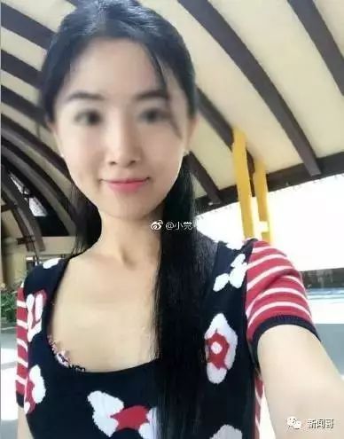 泛亚电竞官网_钼靶检查可排除乳腺增生