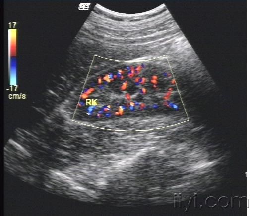 新疆:新疆：休闲观光农业引发产业新变革：泛亚电竞